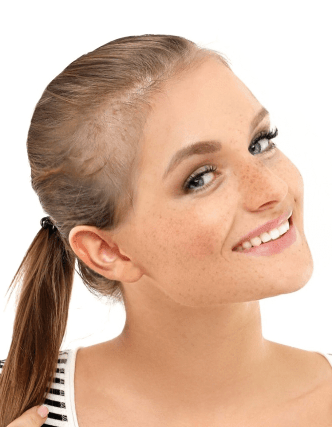 All Female Treatments