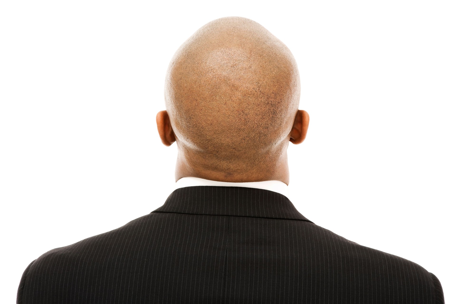 Mature New Zealand  business man bald head from behind suit. Scalp-microsmp.com Can fix it with Male  Scalp Micropigmentation Treatments